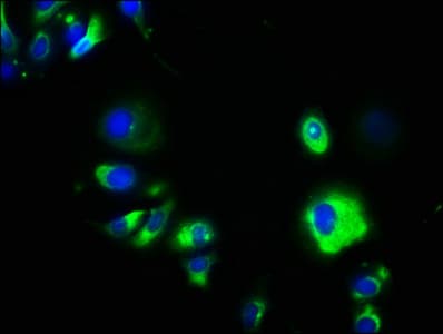IHC-plus™ GPA33 / A33 Antibody