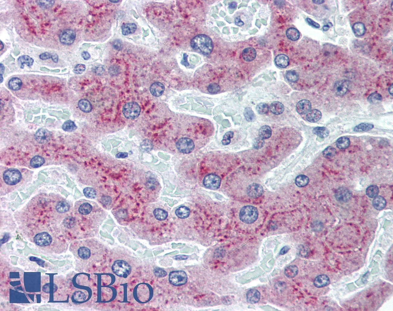 IHC-plus™ Monoclonal Mouse anti-Human RBP4 Antibody (clone 4H7, IHC, WB)