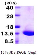 Human DYNLT1 / TCTEX-1 Protein (Recombinant His)