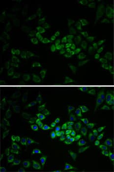 AK1 / Adenylate Kinase 1 Antibody