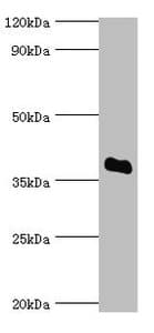 SULT2A1 / Sulfotransferase 2A1 Antibody (aa1-145)