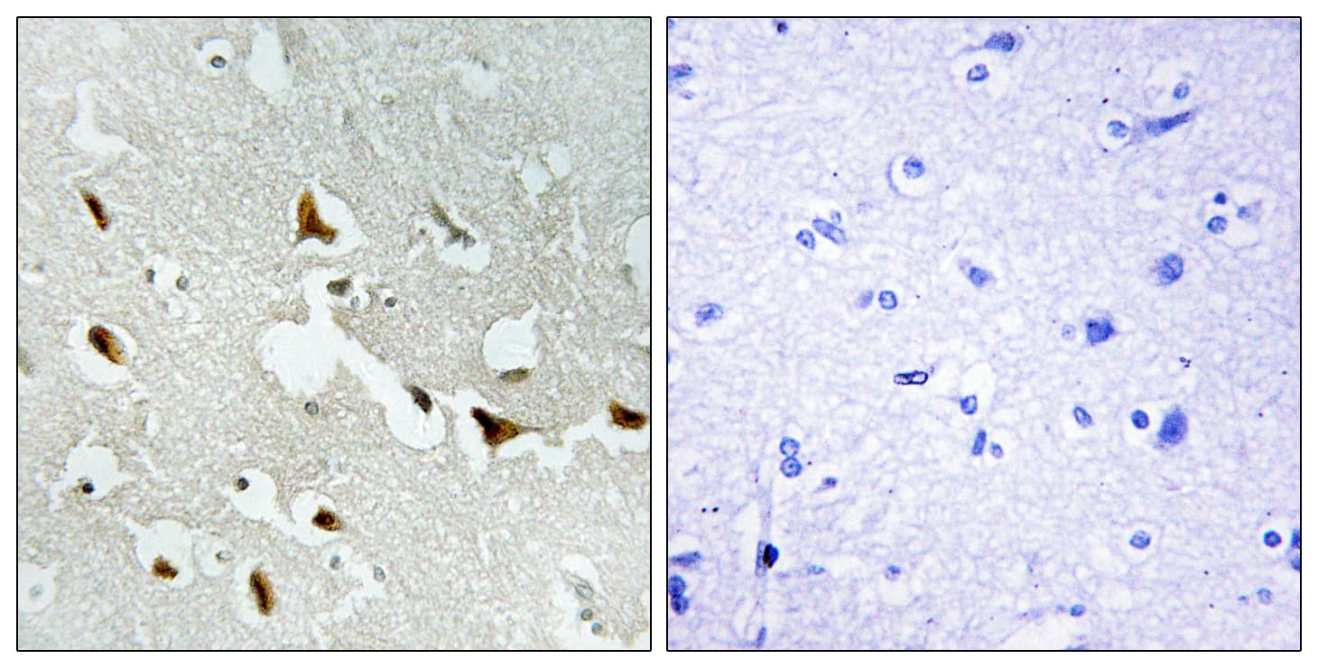 Polyclonal Rabbit anti-Human IRS1 Antibody (aa603-652, IHC)