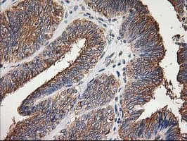 Monoclonal Mouse anti-Human TUBB4 / Tubulin Beta 4 Antibody (clone 6C2, Carrier-free, IHC, IF, WB)