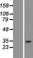 QTRT1 Protein (Over-Expression Lysate Myc-DDK (Flag))