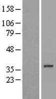 FN3KL / FN3KRP Protein (Over-Expression Lysate Myc-DDK (Flag))