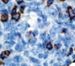 B3GAT1 Antibody