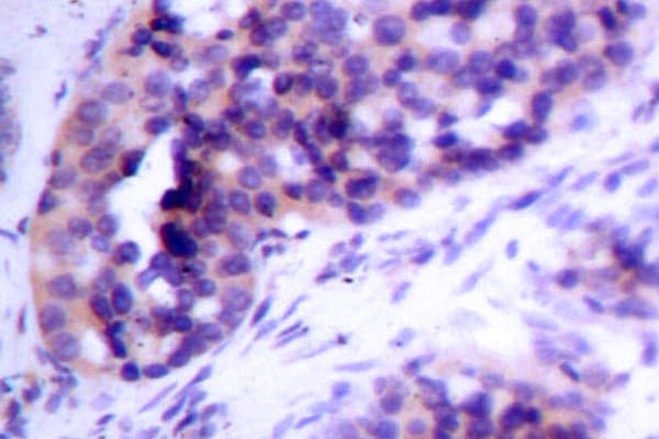 BCL2L1 / BCL-XL Antibody (Ser56)