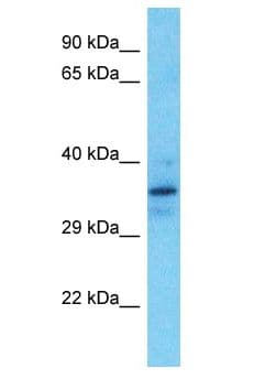 MTAP Antibody (aa113-162)