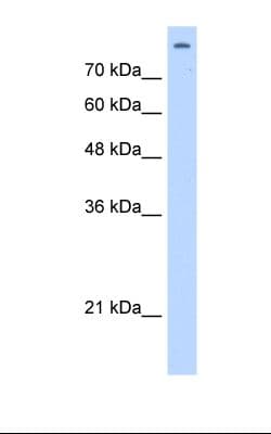 MATR3 / Matrin 3 Antibody (aa751-800, Biotin)