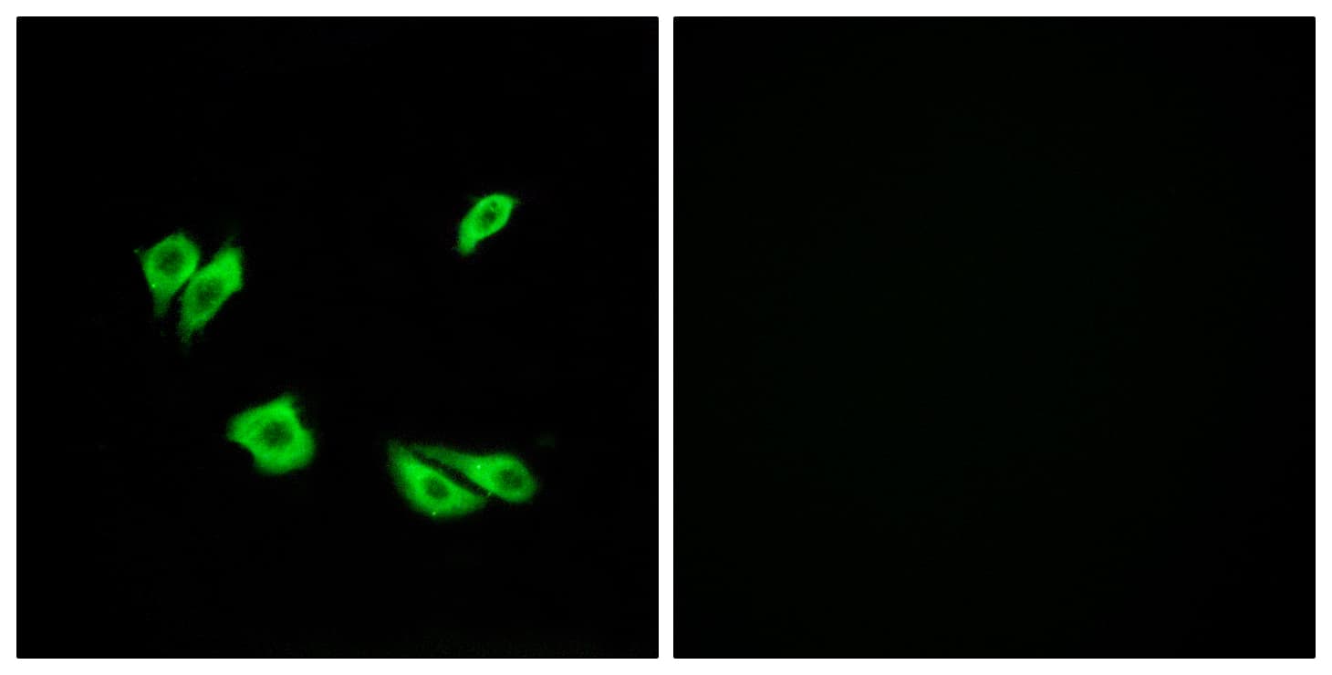 IHC-plus™ DAB1 Antibody (aa187-236)