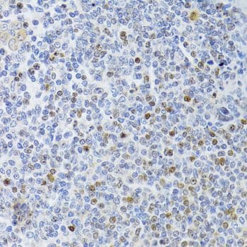 MKI67 / Ki67 Antibody
