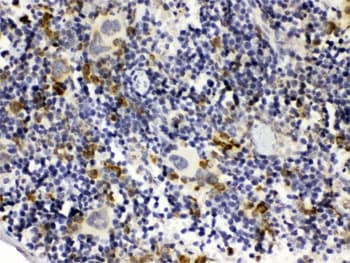 Polyclonal Rabbit anti-Human GC1qR / C1QBP Antibody (IHC, WB)