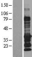 EDARADD Protein (Over-Expression Lysate Myc-DDK (Flag))