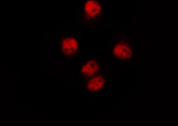 HNRNPC / HNRNP C Antibody (phospho-Ser260)