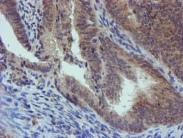 PGM3 Antibody (clone OTI1A11)