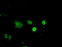 Monoclonal Mouse anti-Human ID3 Antibody (clone OTI8B3, IHC, IF, WB)