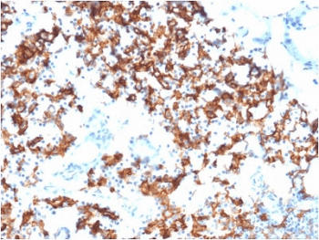 IL3RA / CD123 Antibody (clone IL3RA/1531, Azide-free, BSA-free)