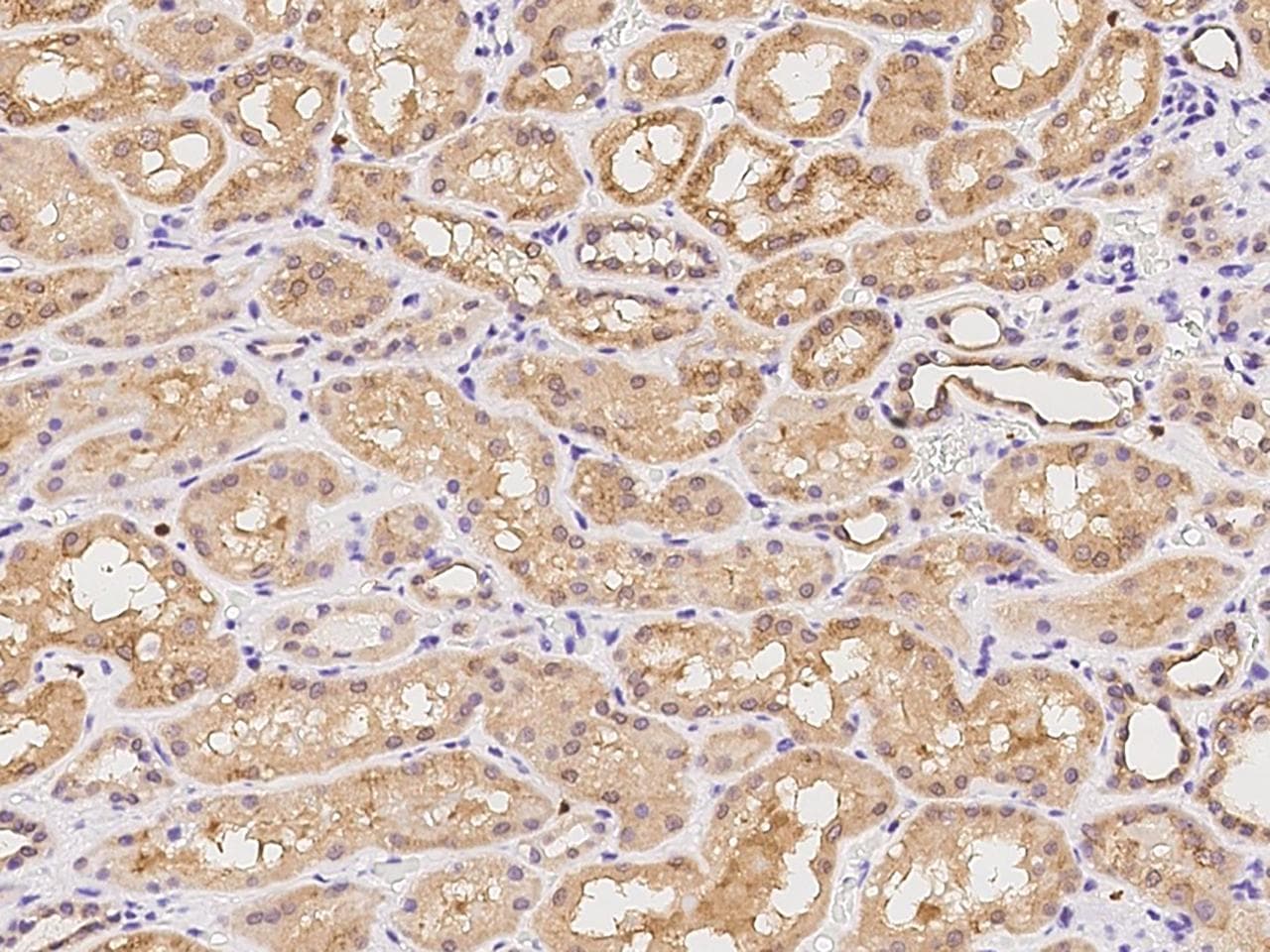 MAP7 Antibody