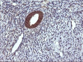 DDT / Dopamine Tautomerase Antibody (clone OTI1H3)