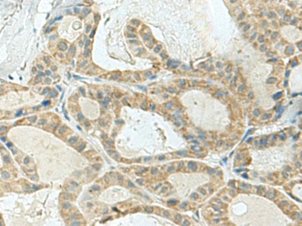 KLC2 Antibody