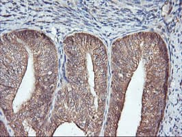 FBXO21 Antibody (clone OTI2C7)