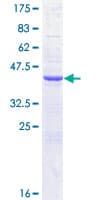 Human CST1 / Cystatin SN Protein (Recombinant GST)