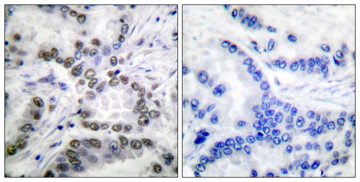 CREBBP / CREB Binding Protein Antibody (Acetyl-Lys1535)