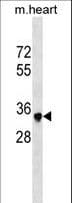 SBK2 Antibody (aa293-320)
