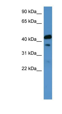 Polyclonal Rabbit anti-Human CALCR / Calcitonin Receptor Antibody (C-Terminus, WB)