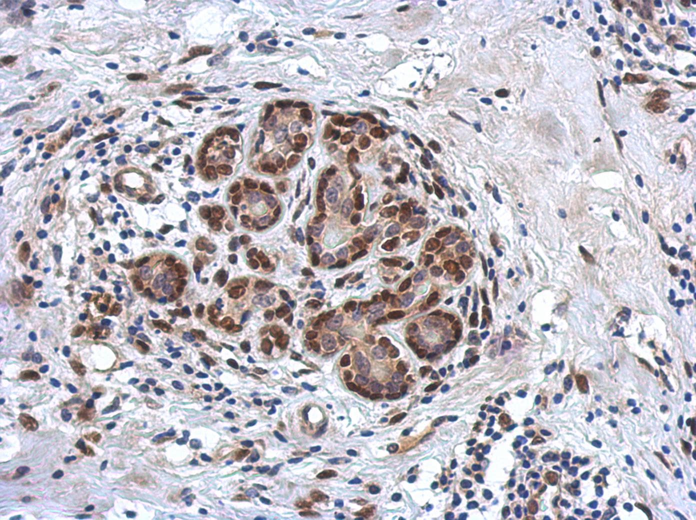 ZBTB20 Antibody