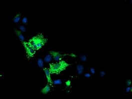 ALOX15 / 15-Lipoxygenase Antibody (clone 7H6, Carrier-free)