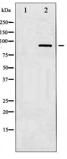 IKK Alpha+Beta Antibody