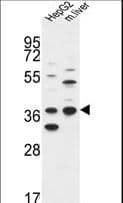 DHRS3 / SDR1 Antibody (aa85-113)