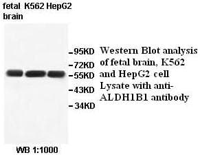 ALDH1B1 Antibody (aa255-489)