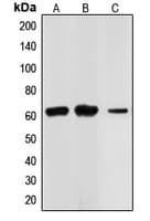 Polyclonal Rabbit anti-Human CHEK2 / CHK2 Antibody (N-Terminus, IHC, IF, WB)