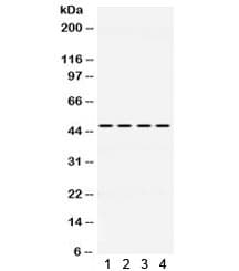 Polyclonal Rabbit anti-Human PAX6 Antibody (IHC, WB)