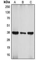 ATF4 Antibody (Internal)