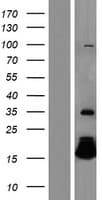 HBQ1 Protein (Over-Expression Lysate Myc-DDK (Flag))