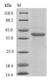 Human BLID Protein (Recombinant GST, N-terminus)