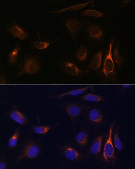 Polyclonal Rabbit anti-Human TMEM49 Antibody (IF)