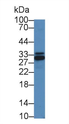 IKBIP Antibody (aa132-314)