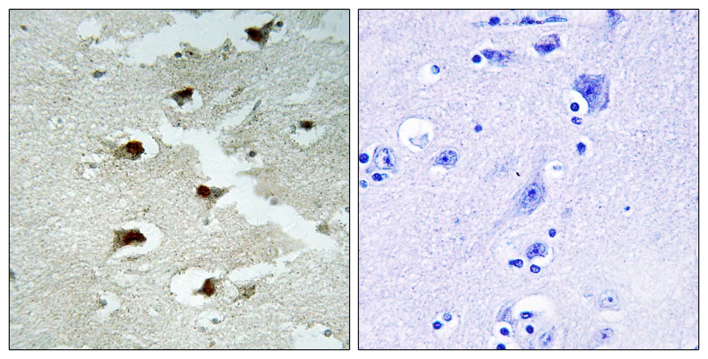 Polyclonal Rabbit anti-Human CDCA4 Antibody (aa121-170, IHC, IF)