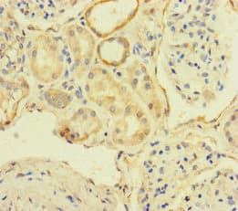 TBC1D24 Antibody