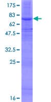 Human SOAT2 Protein (Recombinant GST)
