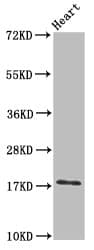 UBE2L3 / UBCH7 Antibody