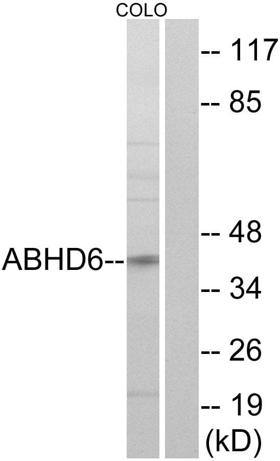 Polyclonal Rabbit anti-Human ABHD6 Antibody (IF, WB)
