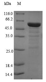 Human EIF3M / PCID1 Protein (Recombinant 6His-SUMO, N-terminus)