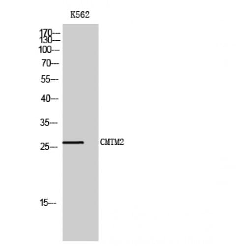 CMTM2 Antibody (140-220 aa, C-terminal)
