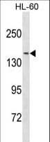 NCOA3 / SRC-3 / AIB1 Antibody (aa344-372)