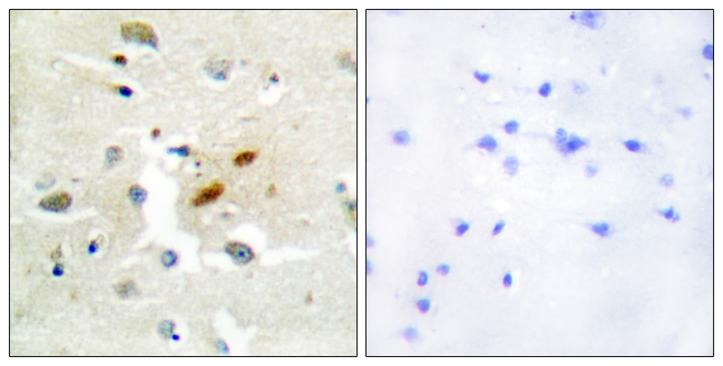 Polyclonal Rabbit anti-Human REV3L / REV3 Antibody (aa231-280, IHC)